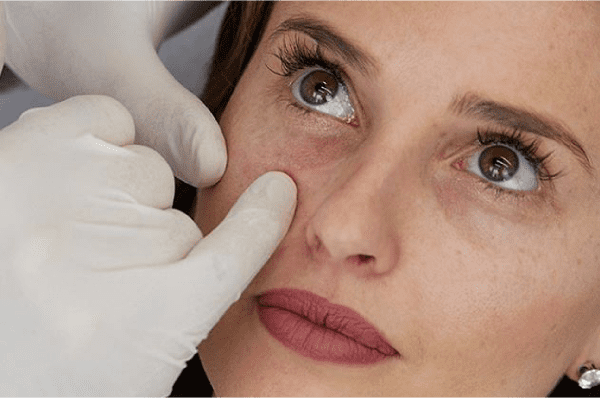 Why the Skin Around Your Eyes Ages So Quickly—and How to Protect It | Observer