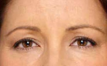 Dr. Dennis Gross Dermatology Before & After Pictures in New York, NY