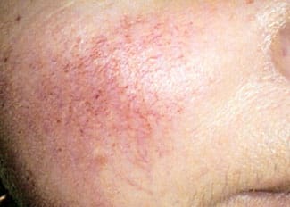 Dr. Dennis Gross Dermatology Before & After Pictures in New York, NY