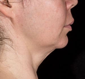 Dr. Dennis Gross Dermatology Before & After Pictures in New York, NY