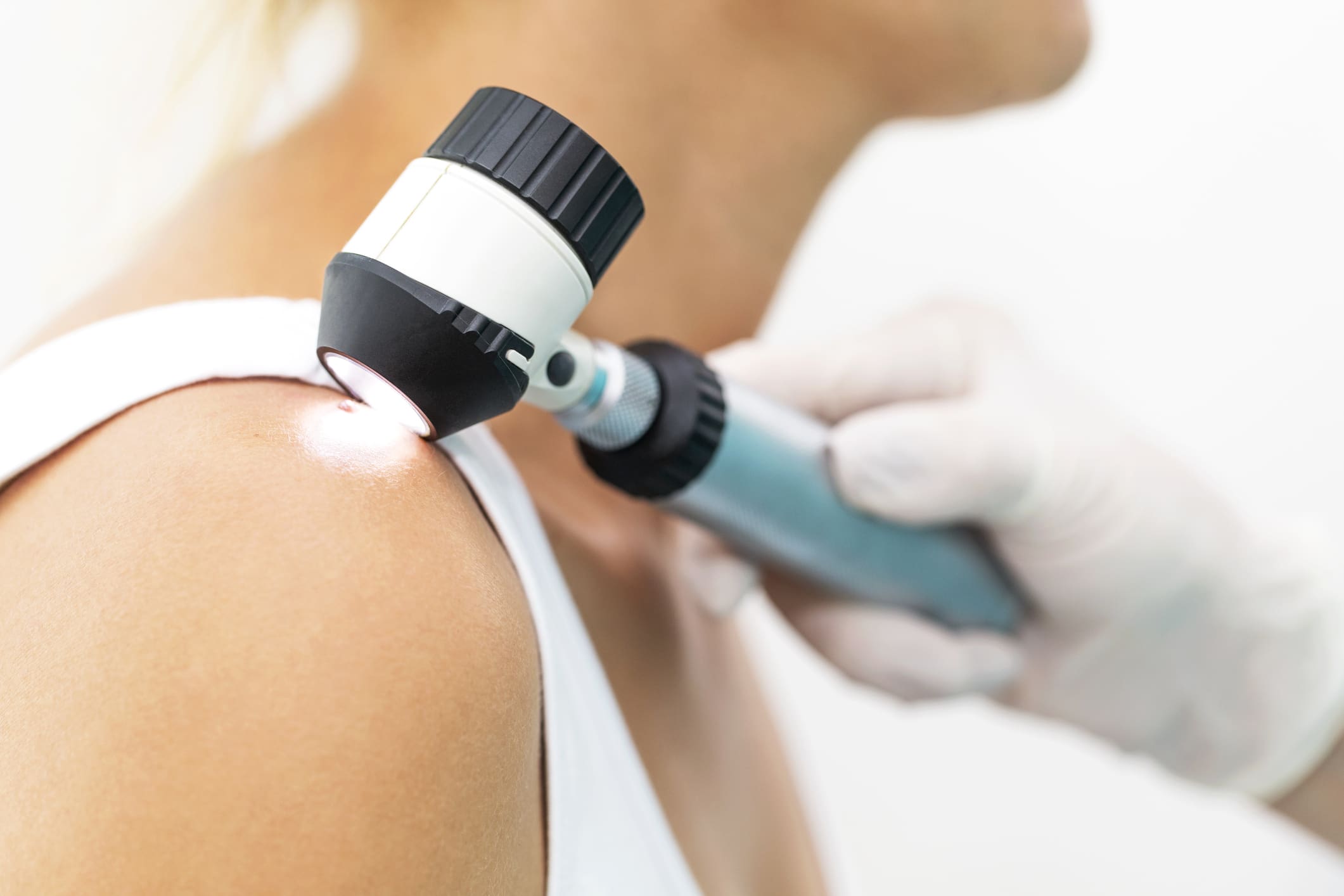 Skin cancer Dermatological Surgery in New York, NY