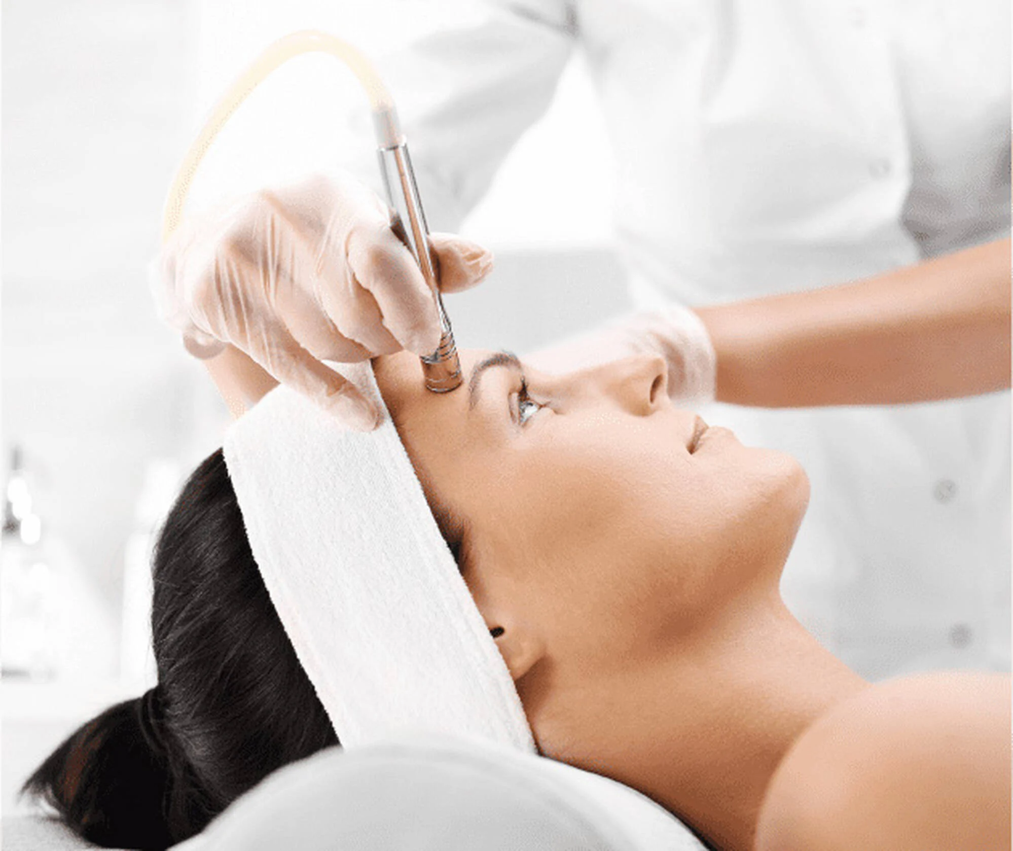 Microneedling in New York, NY